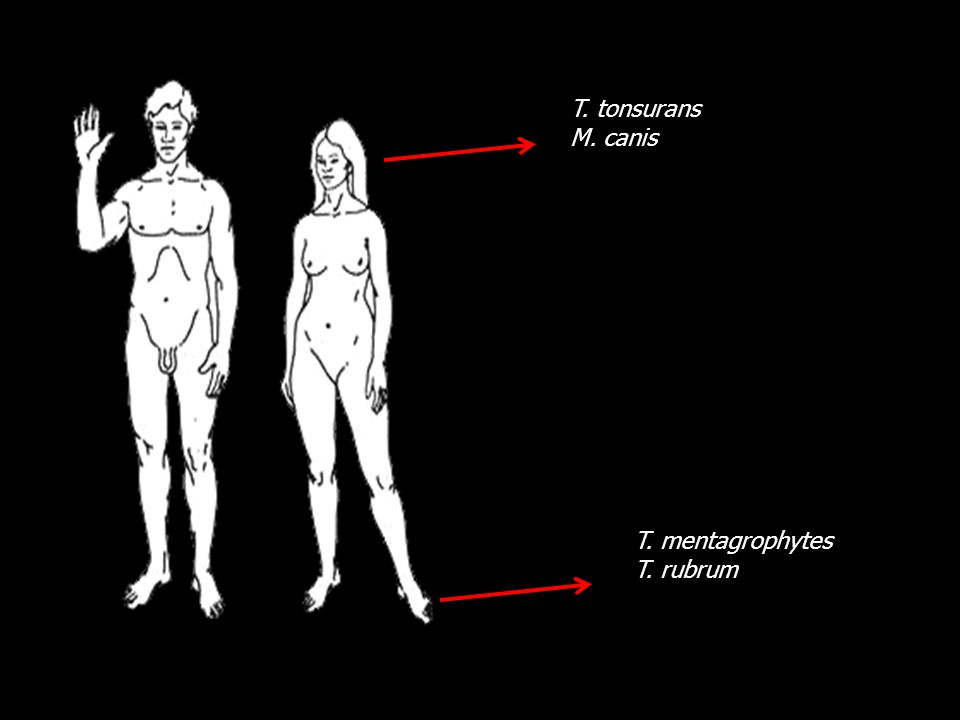 T. tonsurans M. canis T. mentagrophytes T. rubrum