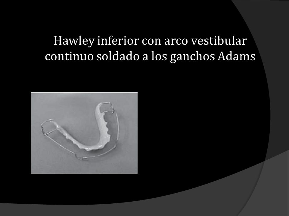 Hawley inferior con arco vestibular continuo soldado a los ganchos Adams