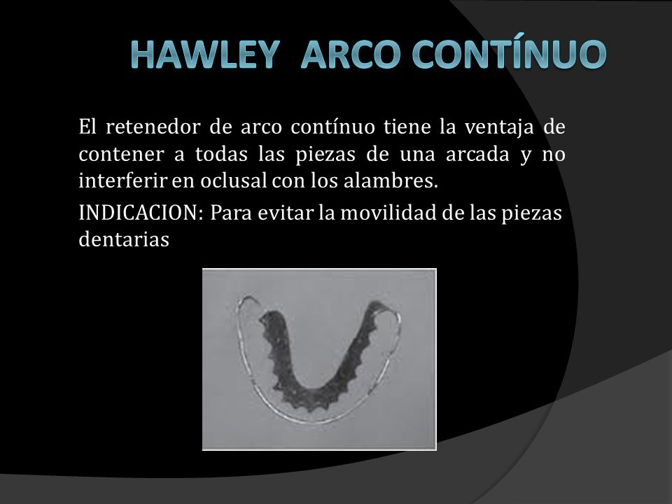 HAWLEY ARCO CONTÍNUO