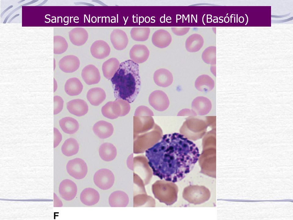Sangre Normal y tipos de PMN (Basófilo)