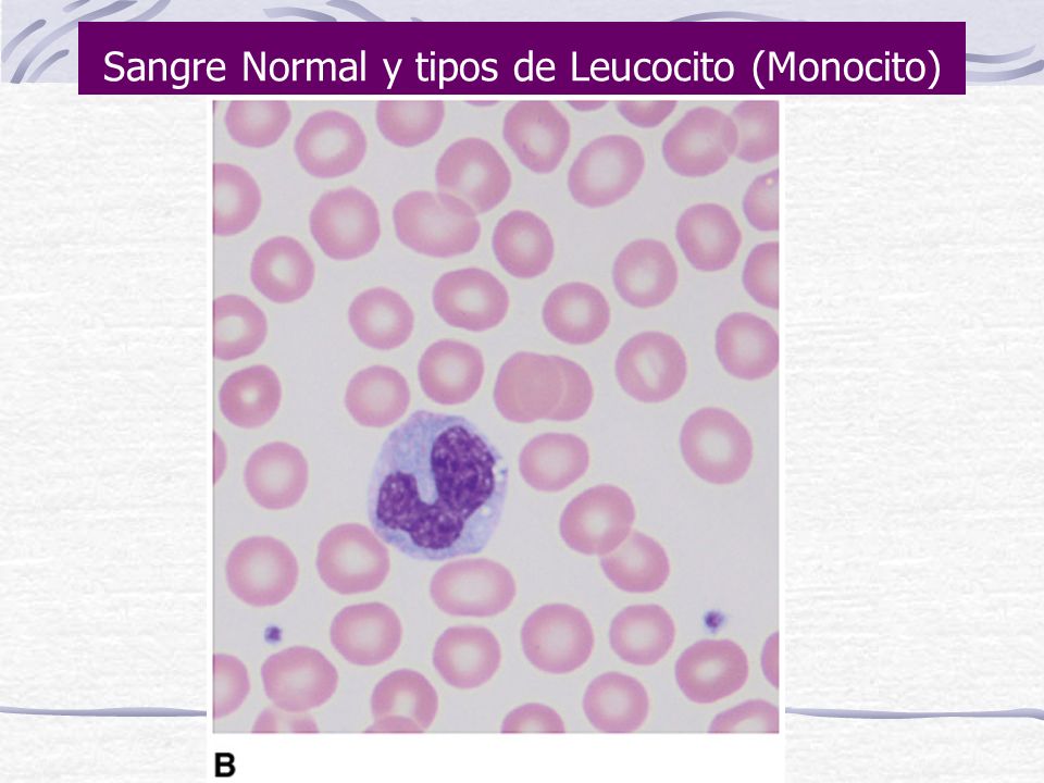 Sangre Normal y tipos de Leucocito (Monocito)