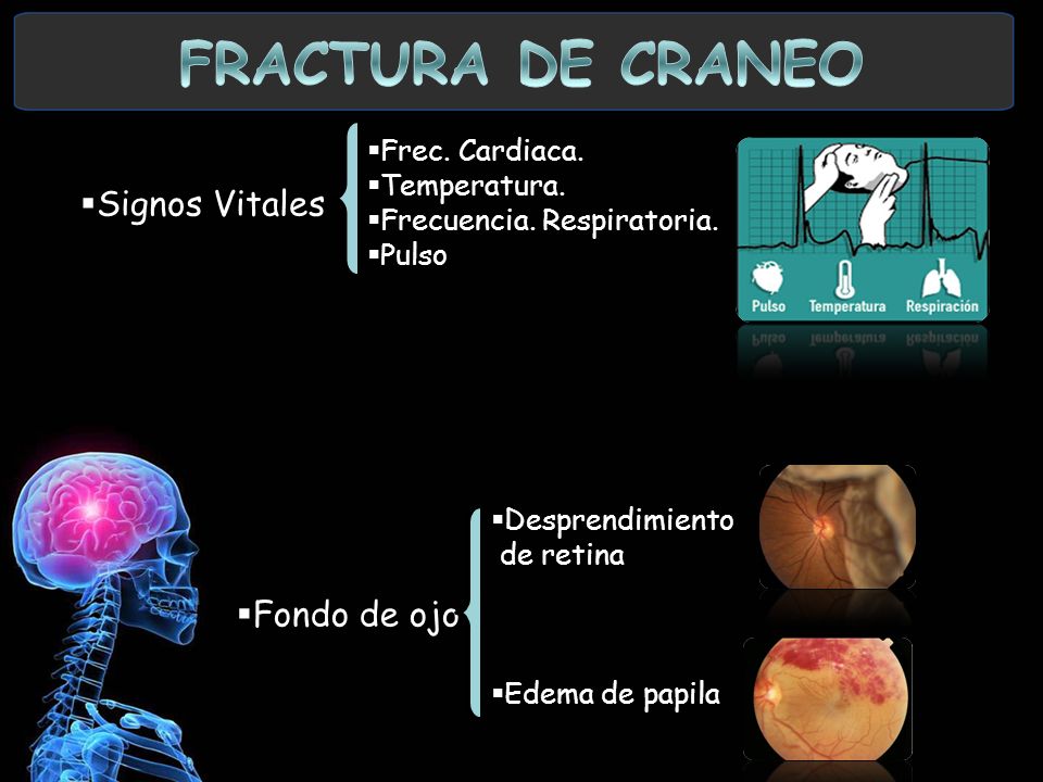 FRACTURA DE CRANEO Signos Vitales Fondo de ojo Frec. Cardiaca.