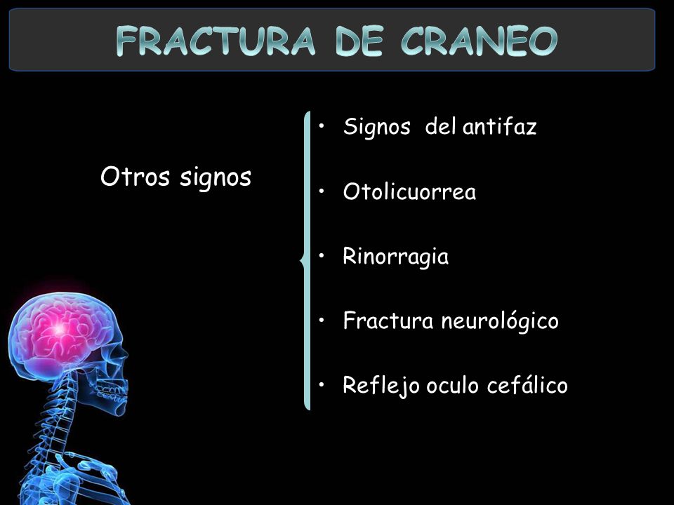 FRACTURA DE CRANEO Otros signos Signos del antifaz Otolicuorrea