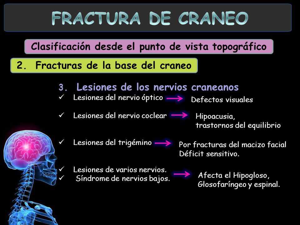 FRACTURA DE CRANEO Clasificación desde el punto de vista topográfico