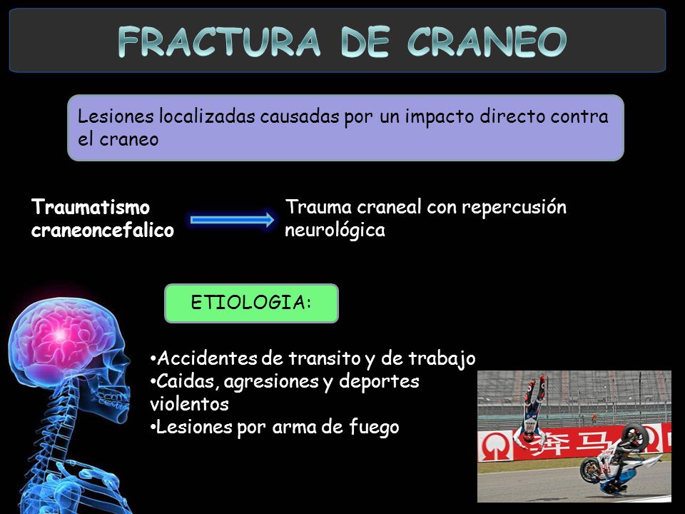FRACTURA DE CRANEO Lesiones localizadas causadas por un impacto directo contra el craneo. Traumatismo.