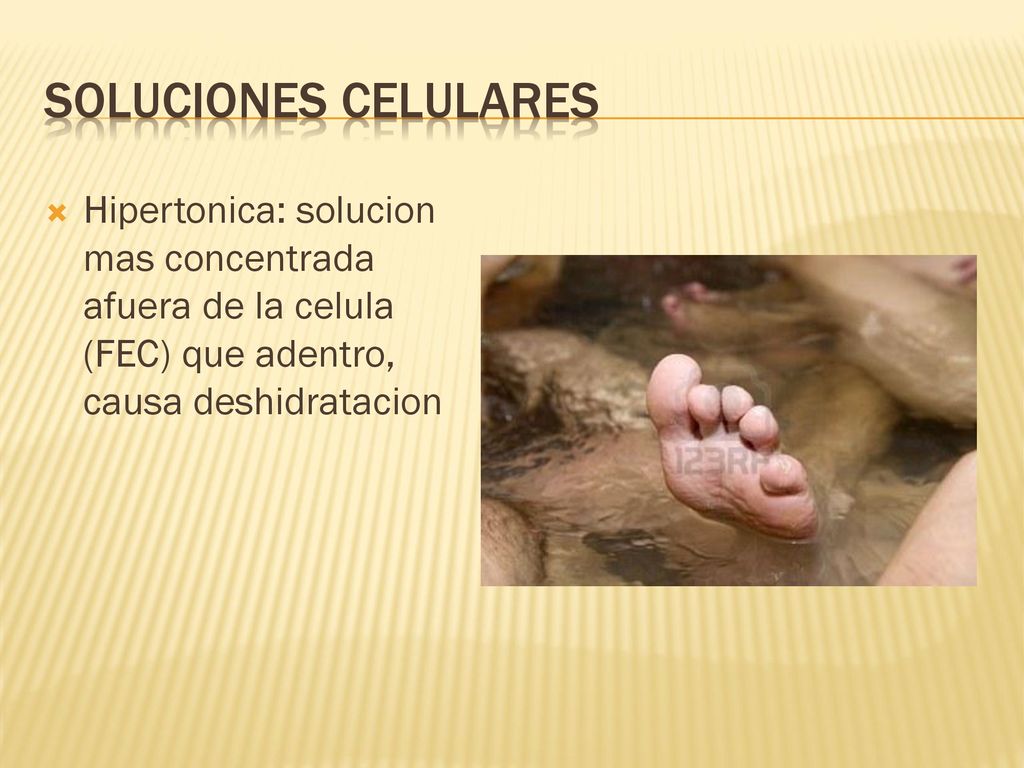 Soluciones Celulares Hipertonica: solucion mas concentrada afuera de la celula (FEC) que adentro, causa deshidratacion.