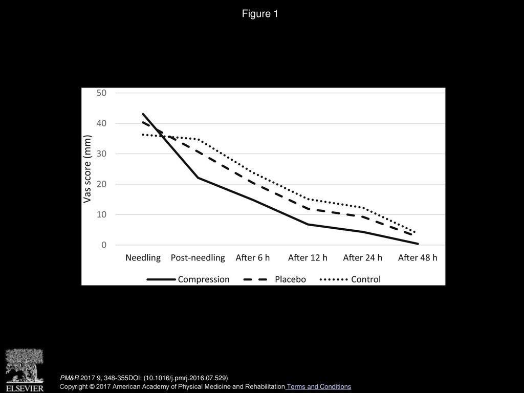 Figure 1 Levels of pain during needling and evolution of pain over time. PM&R , DOI: ( /j.pmrj )
