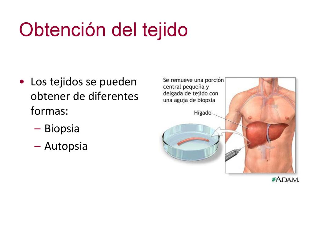 Obtención del tejido Los tejidos se pueden obtener de diferentes formas: Biopsia Autopsia
