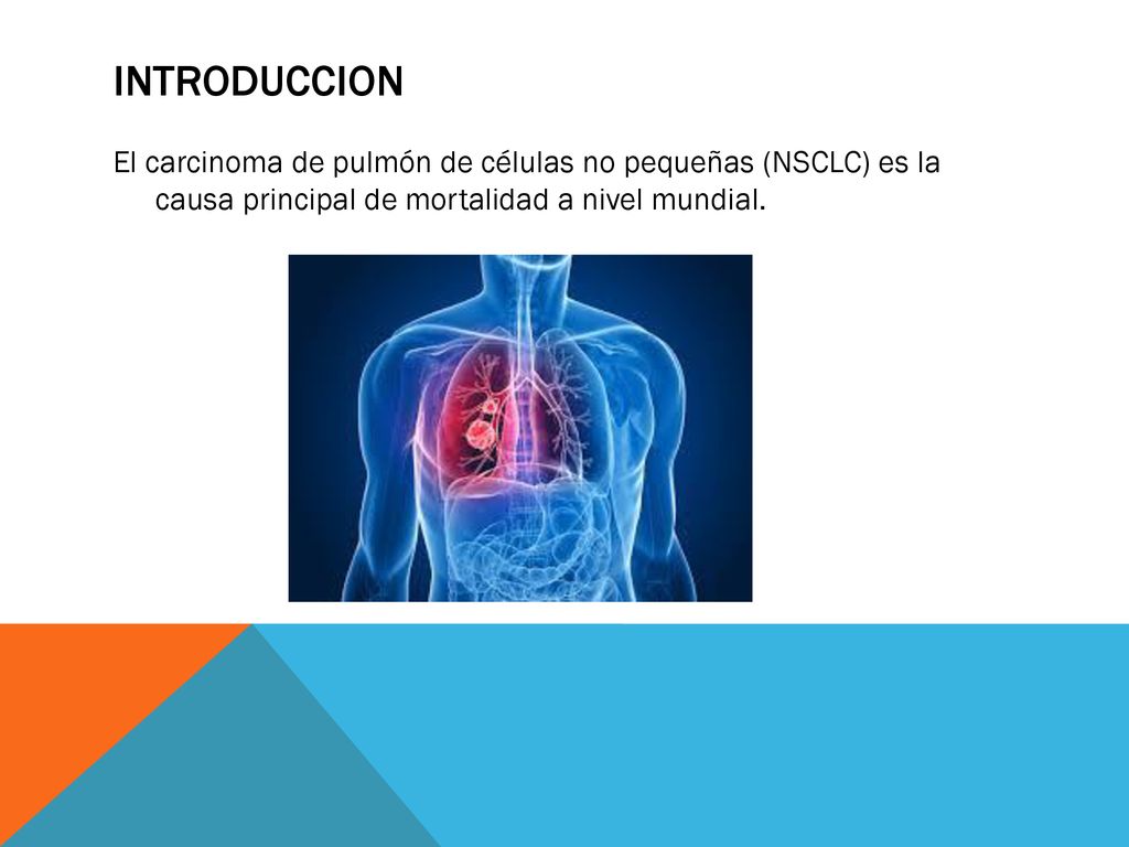 INTRODUCCION El carcinoma de pulmón de células no pequeñas (NSCLC) es la causa principal de mortalidad a nivel mundial.