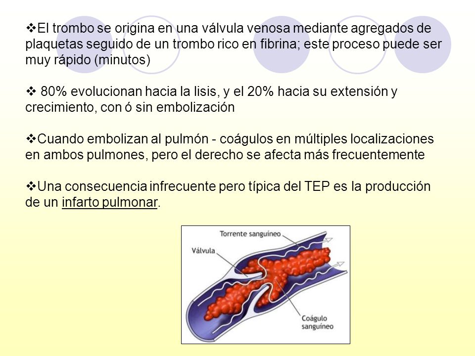 El trombo se origina en una válvula venosa mediante agregados de plaquetas seguido de un trombo rico en fibrina; este proceso puede ser muy rápido (minutos)