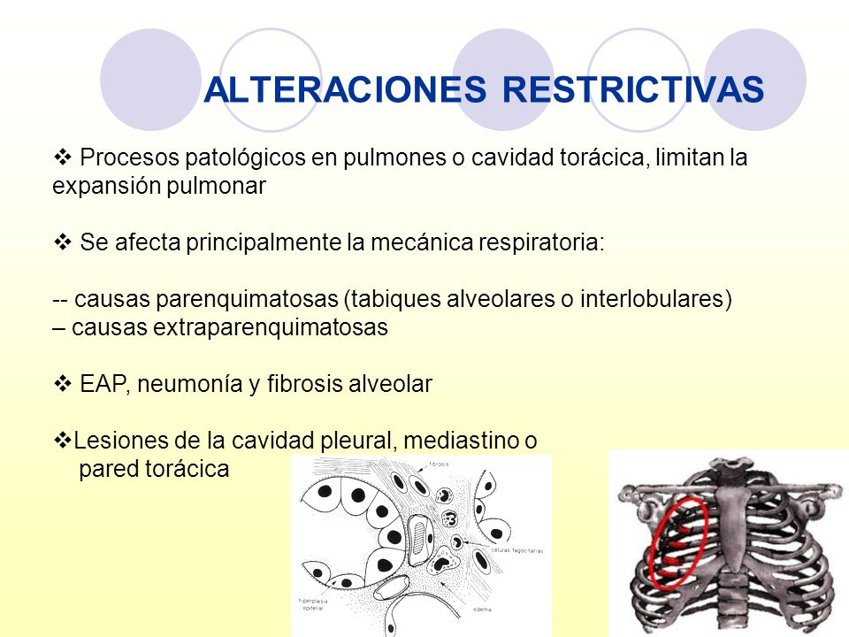 ALTERACIONES RESTRICTIVAS