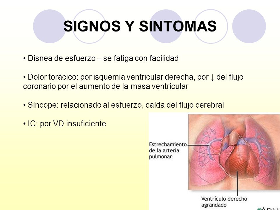 SIGNOS Y SINTOMAS Disnea de esfuerzo – se fatiga con facilidad