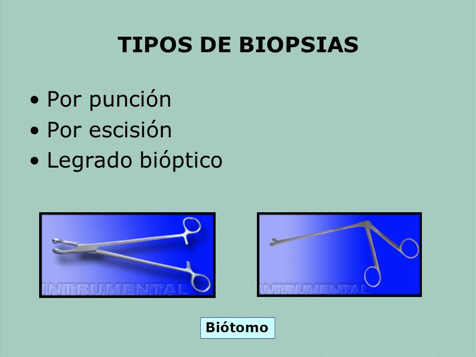 TIPOS DE BIOPSIAS Por punción Por escisión Legrado bióptico Biótomo