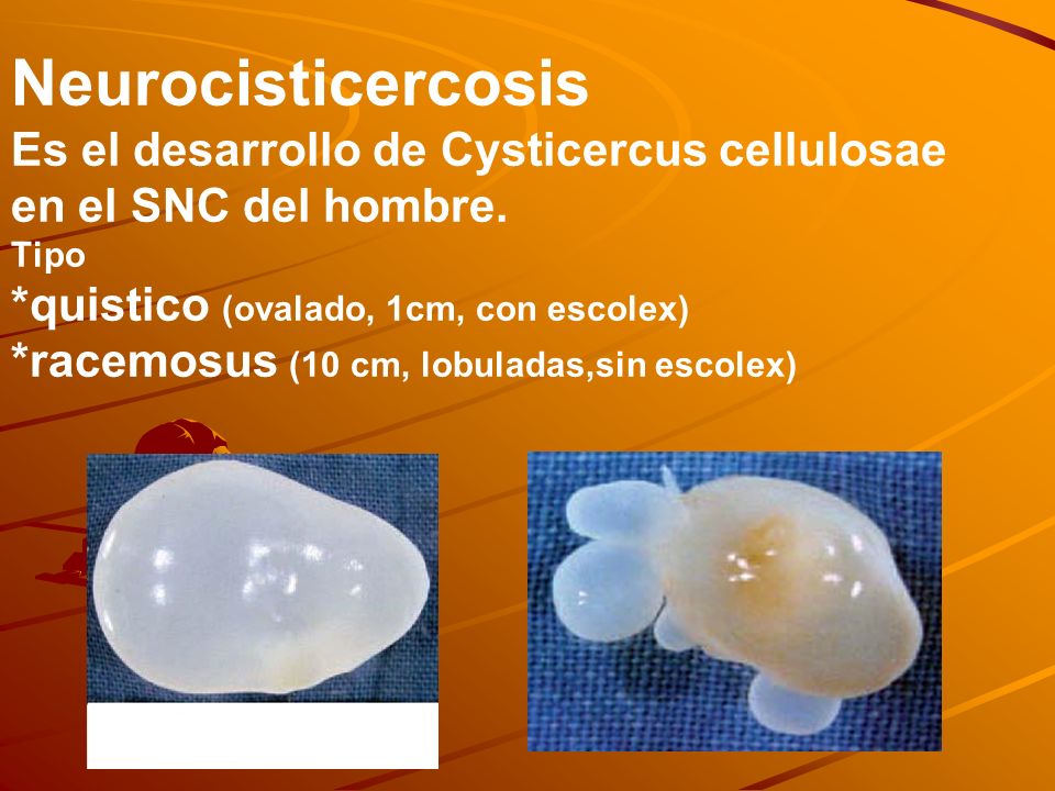 Neurocisticercosis Es el desarrollo de Cysticercus cellulosae en el SNC del hombre.