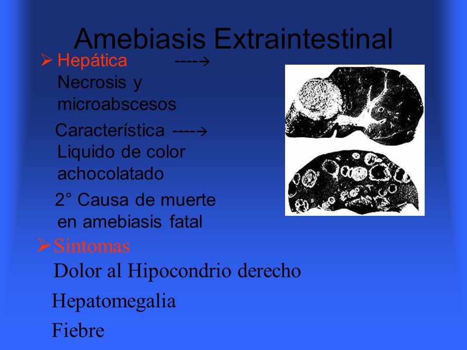 Amebiasis Extraintestinal