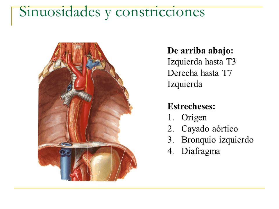 Sinuosidades y constricciones