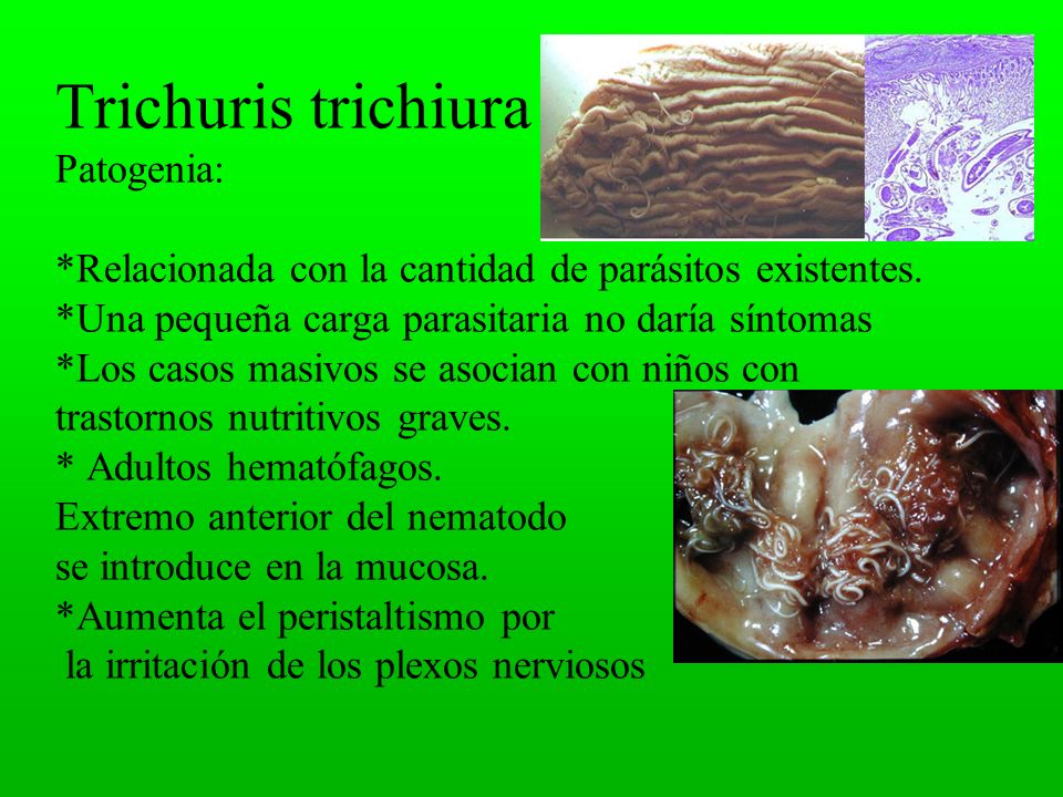 Trichuris trichiura Trichuriasis. Nematodo. Habitat: Intestino grueso - ppt  video online descargar