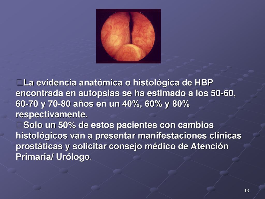 La evidencia anatómica o histológica de HBP encontrada en autopsias se ha estimado a los 50-60, y años en un 40%, 60% y 80% respectivamente.