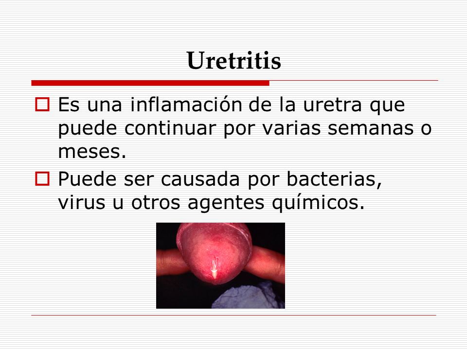 Uretritis Es una inflamación de la uretra que puede continuar por varias semanas o meses.
