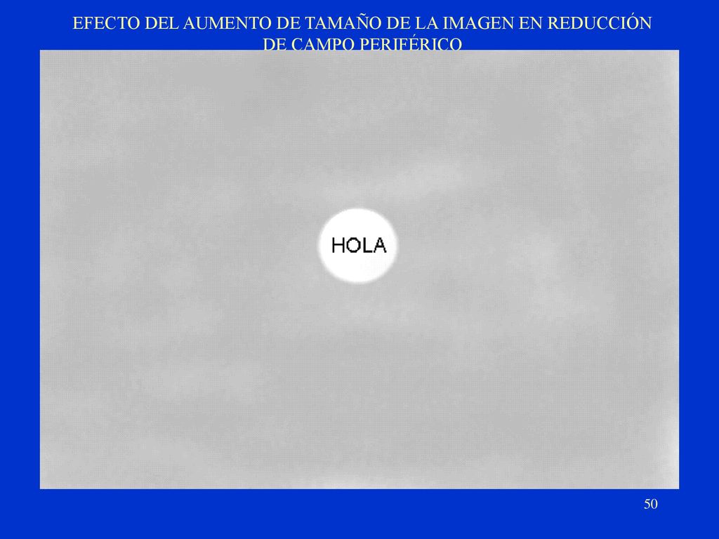EFECTO DEL AUMENTO DE TAMAÑO DE LA IMAGEN EN REDUCCIÓN DE CAMPO PERIFÉRICO