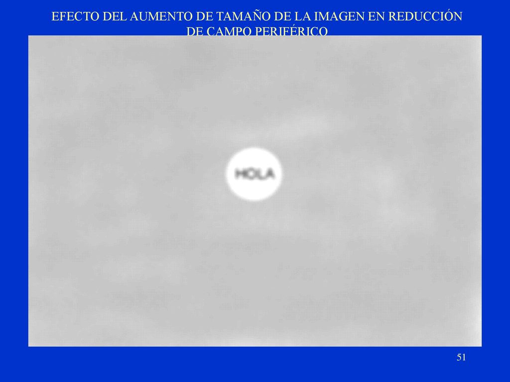 EFECTO DEL AUMENTO DE TAMAÑO DE LA IMAGEN EN REDUCCIÓN DE CAMPO PERIFÉRICO