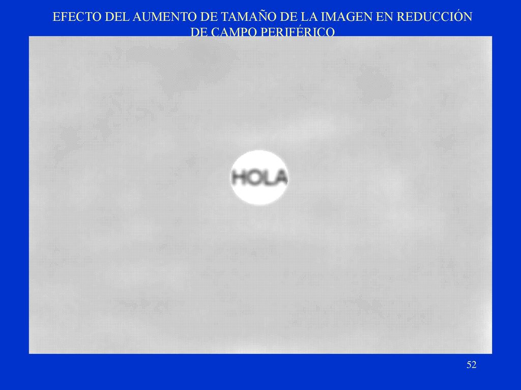 EFECTO DEL AUMENTO DE TAMAÑO DE LA IMAGEN EN REDUCCIÓN DE CAMPO PERIFÉRICO