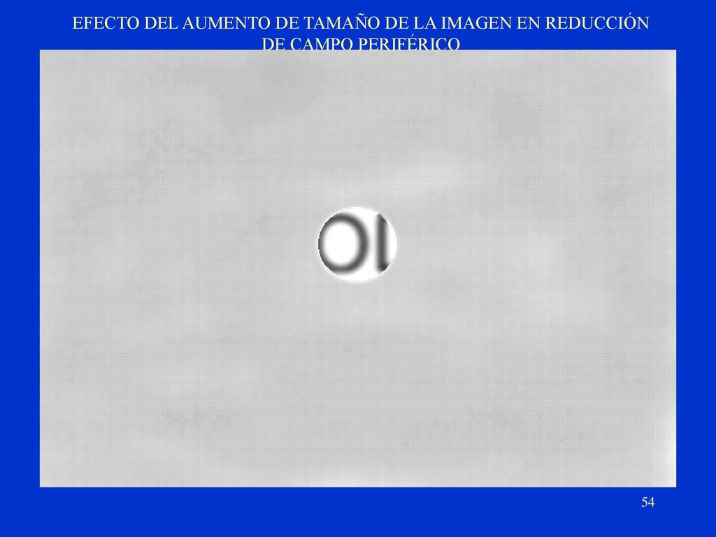 EFECTO DEL AUMENTO DE TAMAÑO DE LA IMAGEN EN REDUCCIÓN DE CAMPO PERIFÉRICO