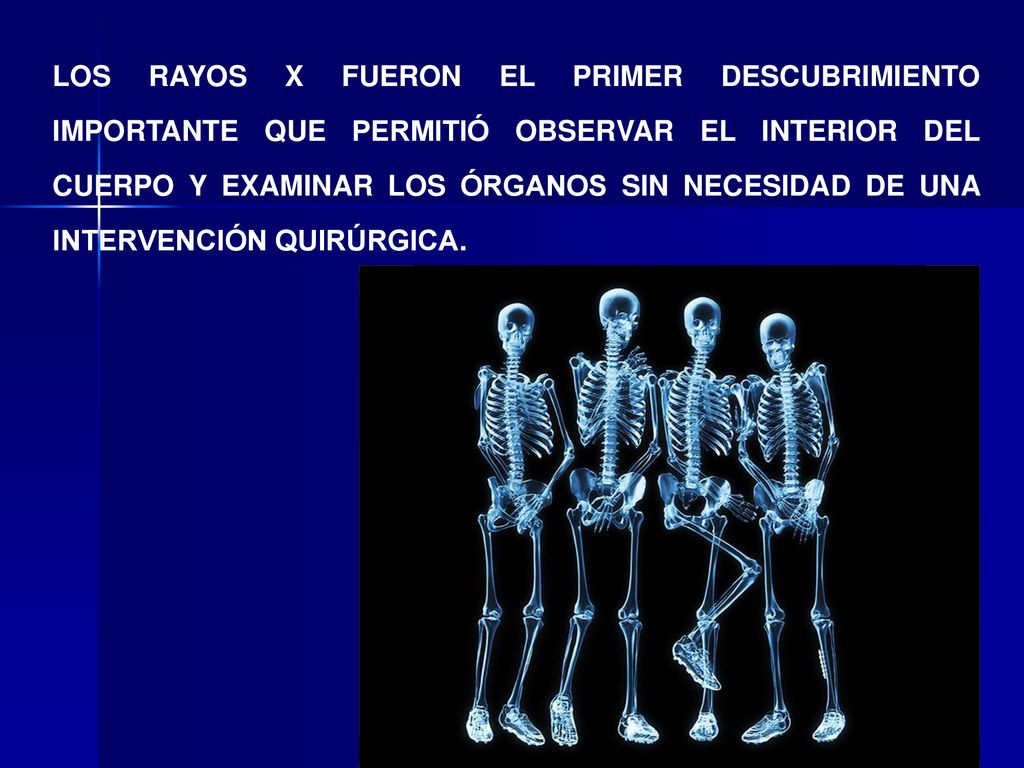 LOS RAYOS X FUERON EL PRIMER DESCUBRIMIENTO IMPORTANTE QUE PERMITIÓ OBSERVAR EL INTERIOR DEL CUERPO Y EXAMINAR LOS ÓRGANOS SIN NECESIDAD DE UNA INTERVENCIÓN QUIRÚRGICA.