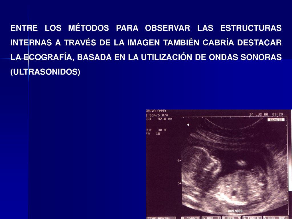 ENTRE LOS MÉTODOS PARA OBSERVAR LAS ESTRUCTURAS INTERNAS A TRAVÉS DE LA IMAGEN TAMBIÉN CABRÍA DESTACAR LA ECOGRAFÍA, BASADA EN LA UTILIZACIÓN DE ONDAS SONORAS (ULTRASONIDOS)