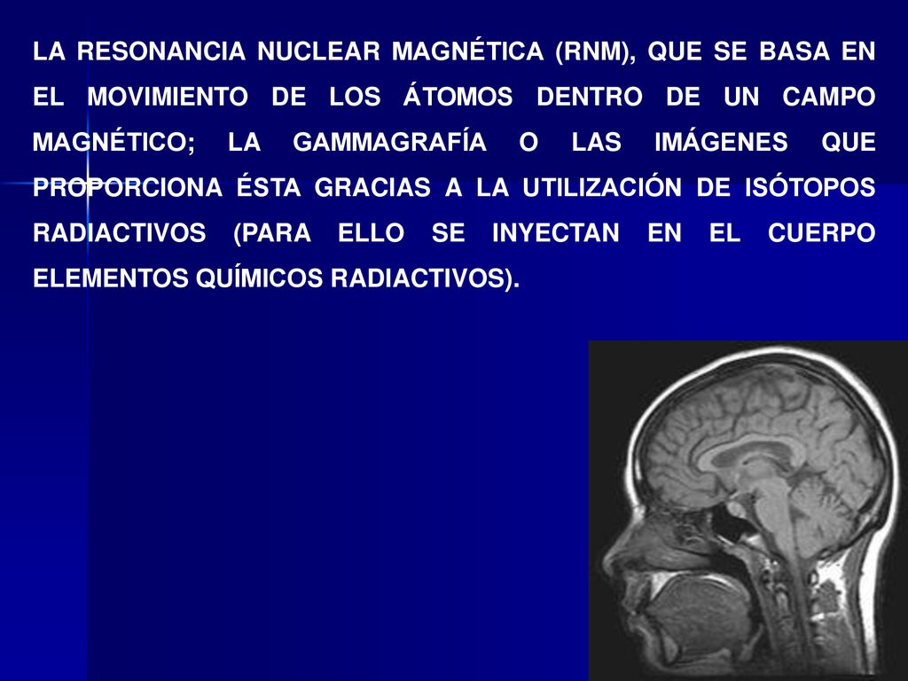 LA RESONANCIA NUCLEAR MAGNÉTICA (RNM), QUE SE BASA EN EL MOVIMIENTO DE LOS ÁTOMOS DENTRO DE UN CAMPO MAGNÉTICO; LA GAMMAGRAFÍA O LAS IMÁGENES QUE PROPORCIONA ÉSTA GRACIAS A LA UTILIZACIÓN DE ISÓTOPOS RADIACTIVOS (PARA ELLO SE INYECTAN EN EL CUERPO ELEMENTOS QUÍMICOS RADIACTIVOS).