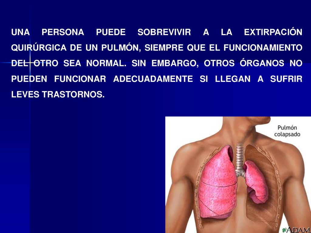 UNA PERSONA PUEDE SOBREVIVIR A LA EXTIRPACIÓN QUIRÚRGICA DE UN PULMÓN, SIEMPRE QUE EL FUNCIONAMIENTO DEL OTRO SEA NORMAL.