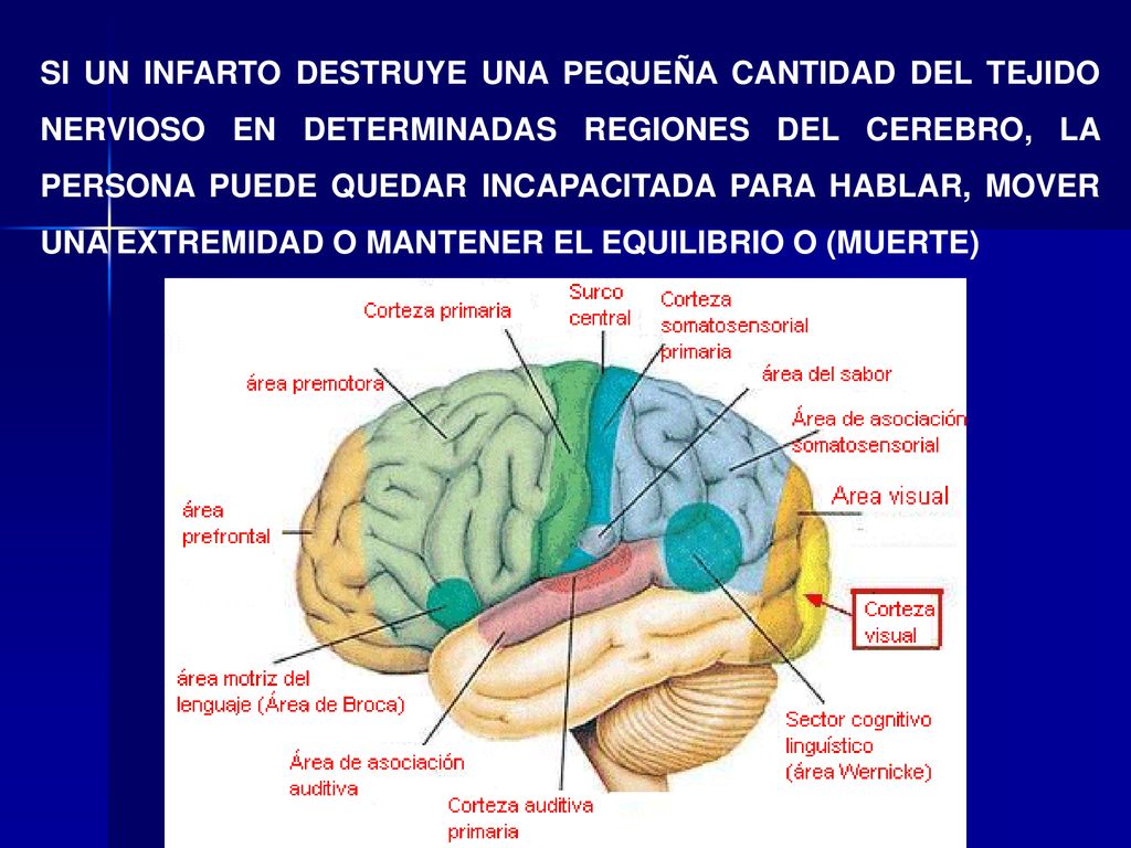 SI UN INFARTO DESTRUYE UNA PEQUEÑA CANTIDAD DEL TEJIDO NERVIOSO EN DETERMINADAS REGIONES DEL CEREBRO, LA PERSONA PUEDE QUEDAR INCAPACITADA PARA HABLAR, MOVER UNA EXTREMIDAD O MANTENER EL EQUILIBRIO O (MUERTE)