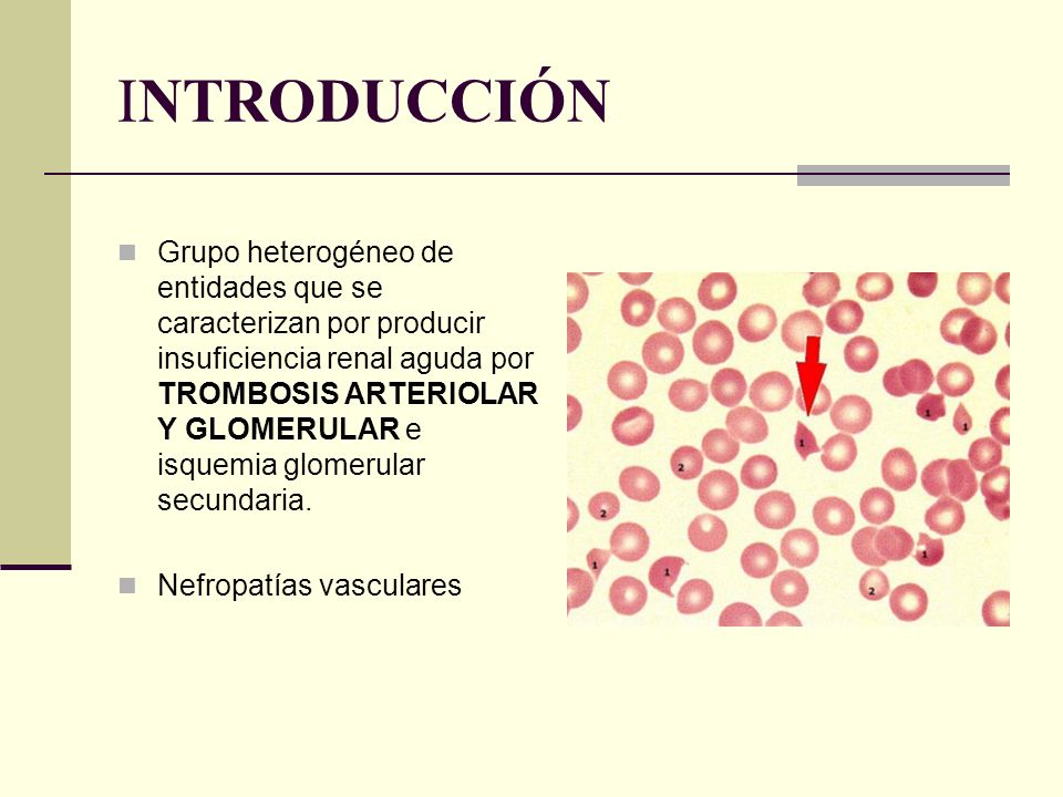 INTRODUCCIÓN
