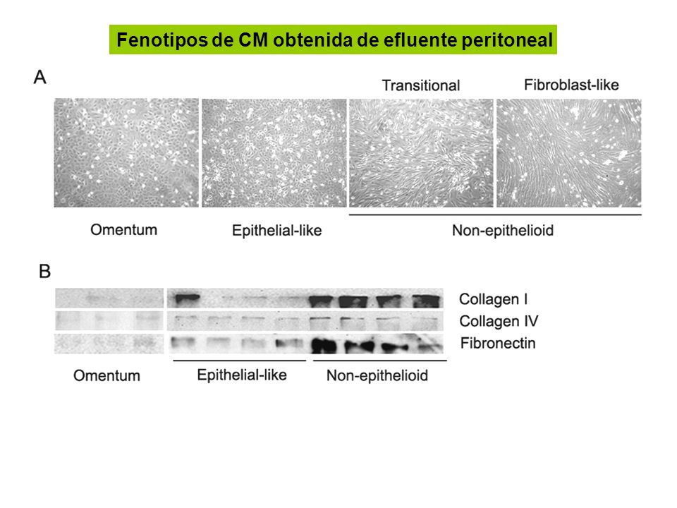 Fenotipos de CM obtenida de efluente peritoneal