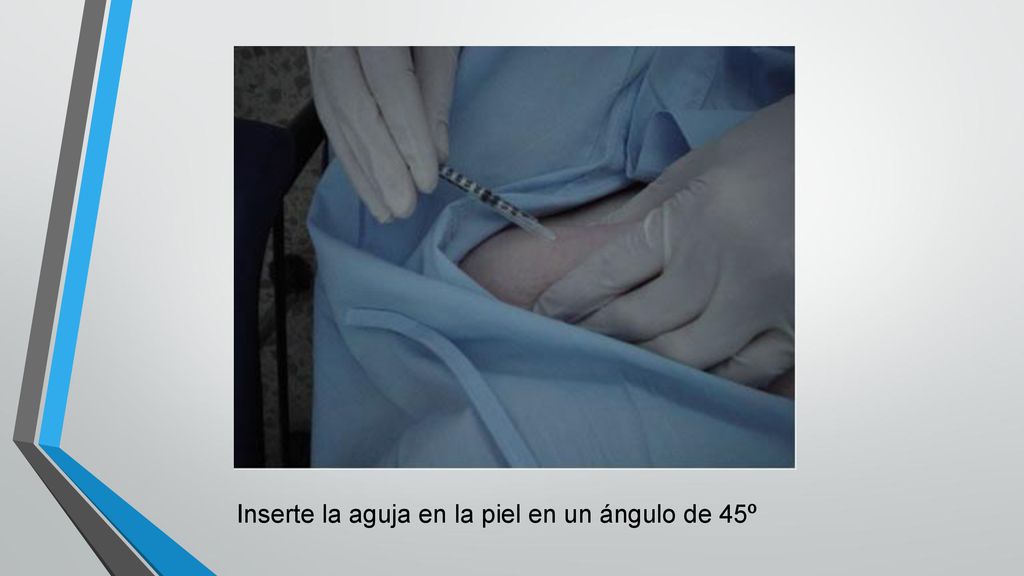 Inserte la aguja en la piel en un ángulo de 45º