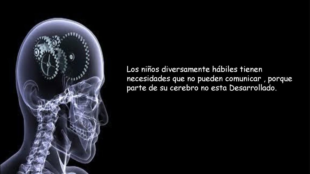 Los niños diversamente hábiles tienen necesidades que no pueden comunicar , porque parte de su cerebro no esta Desarrollado.