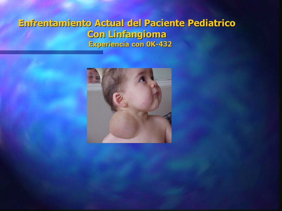 Enfrentamiento Actual del Paciente Pediatrico Con Linfangioma Experiencia con 0K-432