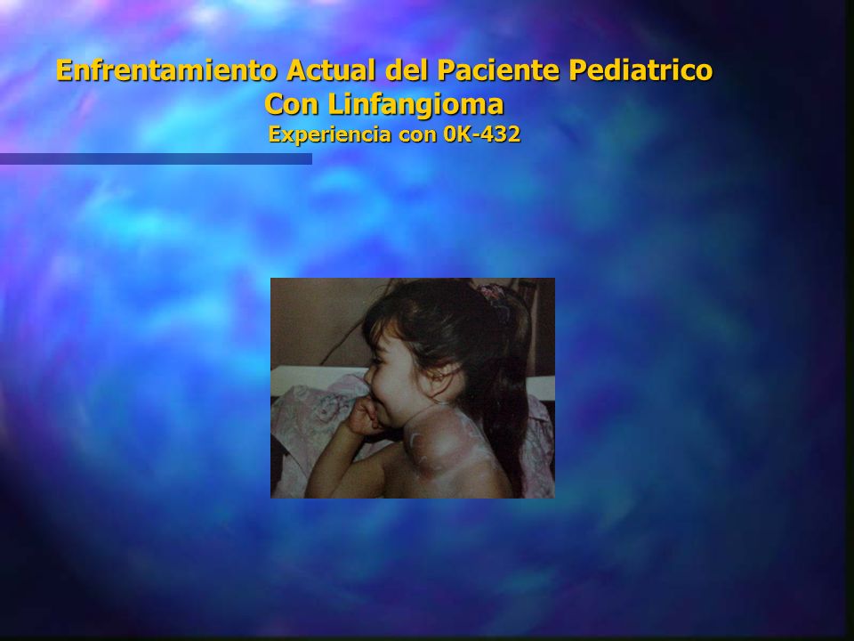 Enfrentamiento Actual del Paciente Pediatrico Con Linfangioma Experiencia con 0K-432