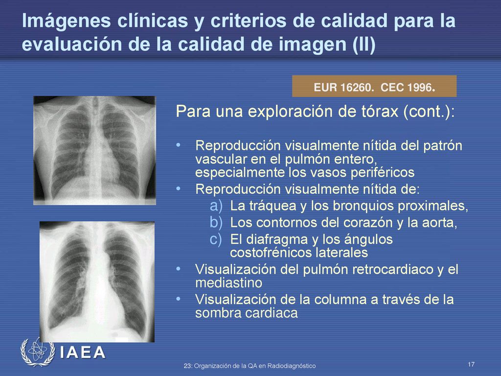 Imágenes clínicas y criterios de calidad para la evaluación de la calidad de imagen (II)
