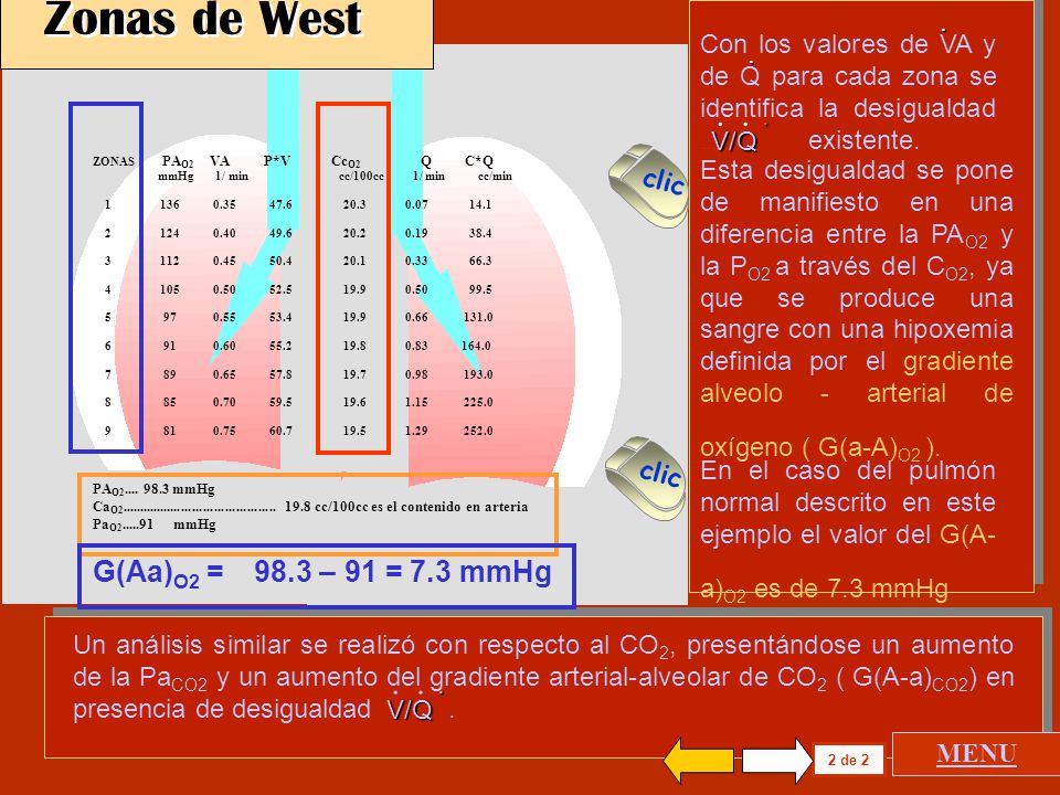 Zonas de West G(Aa)O2 = 98.3 – 91 = 7.3 mmHg .
