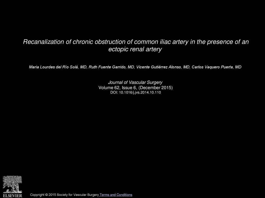 Recanalization of chronic obstruction of common iliac artery in the presence of an ectopic renal artery