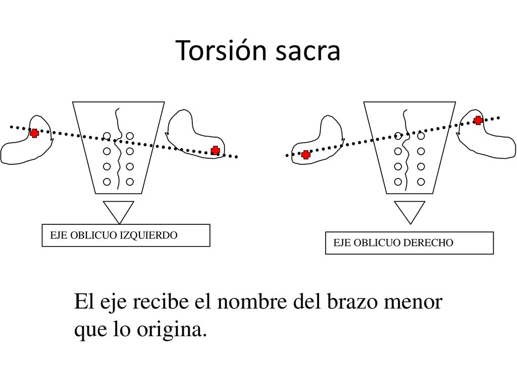 Torsión sacra El eje recibe el nombre del brazo menor que lo origina.