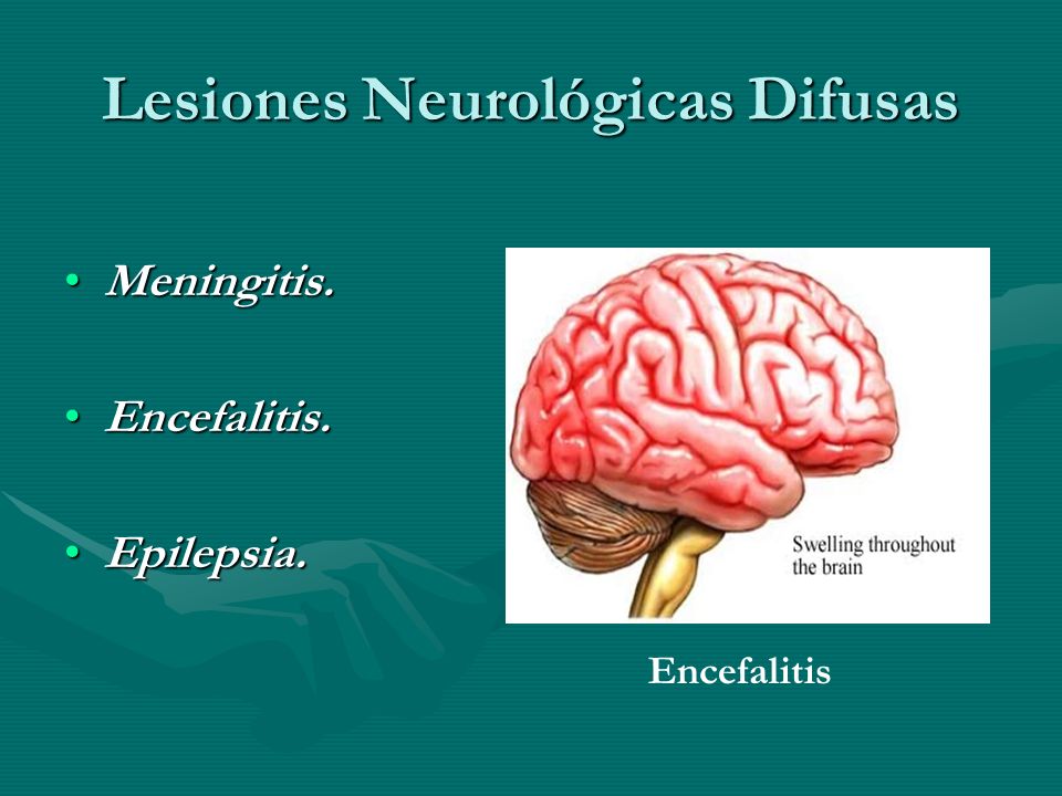 Lesiones Neurológicas Difusas