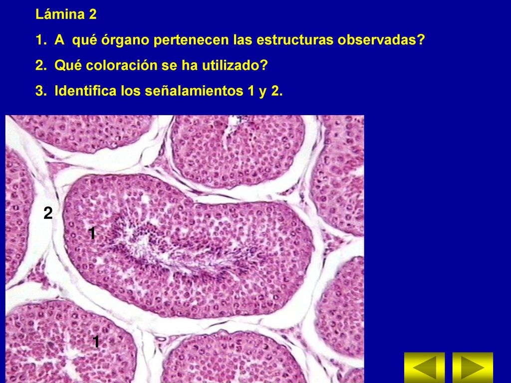 2 1 Lámina 2 A qué órgano pertenecen las estructuras observadas