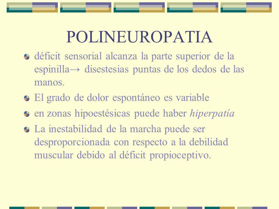 POLINEUROPATIA déficit sensorial alcanza la parte superior de la espinilla→ disestesias puntas de los dedos de las manos.