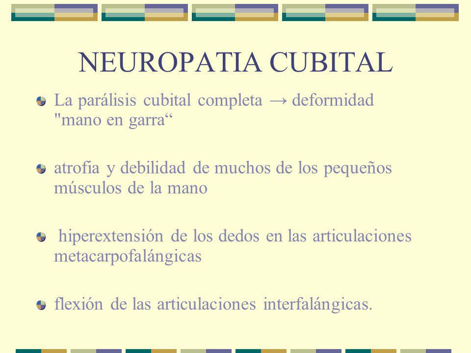 NEUROPATIA CUBITAL La parálisis cubital completa → deformidad mano en garra atrofia y debilidad de muchos de los pequeños músculos de la mano.