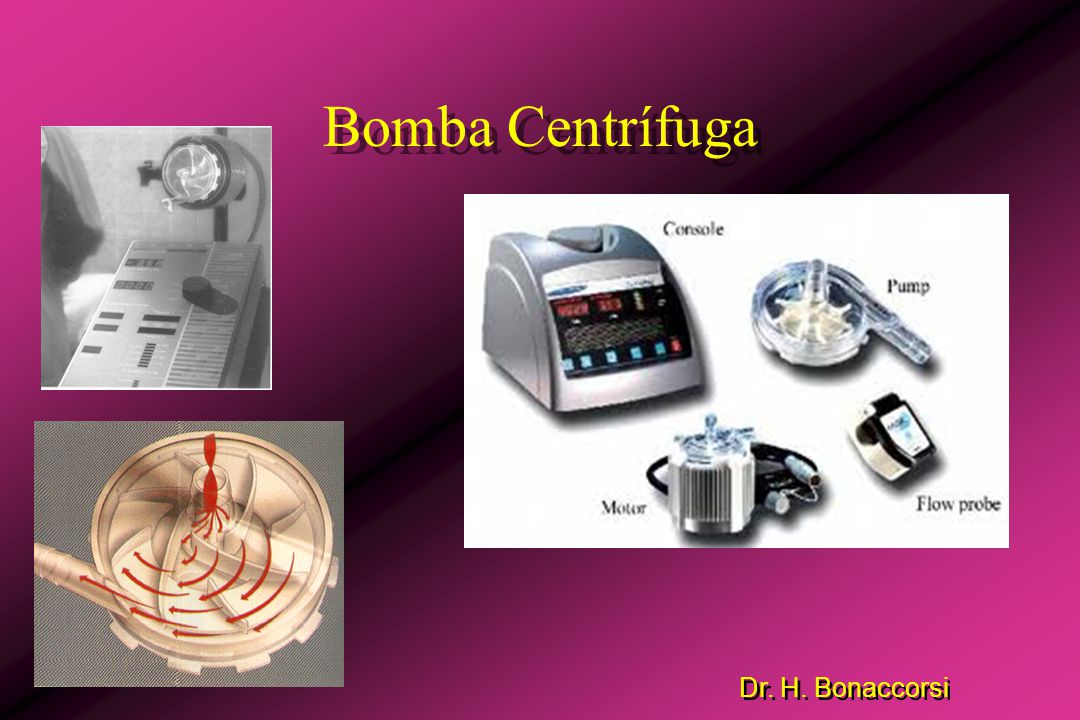 Bomba Centrífuga