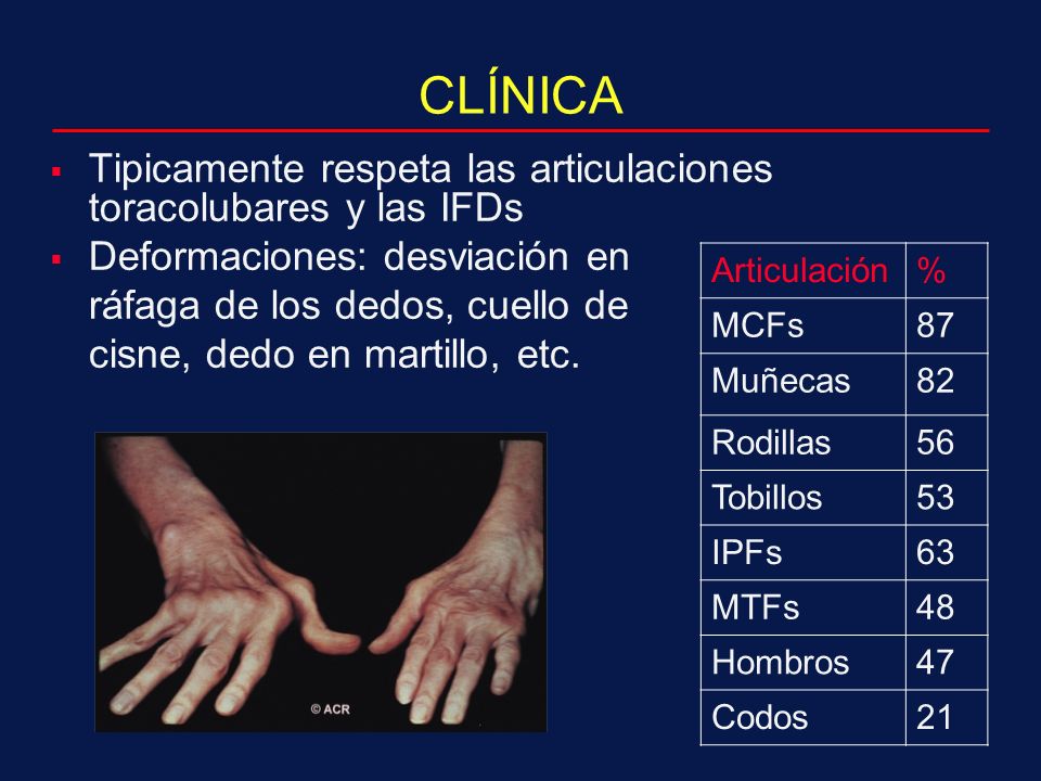 CLÍNICA Tipicamente respeta las articulaciones toracolubares y las IFDs. Deformaciones: desviación en.