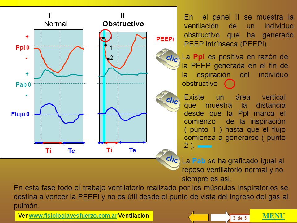 I II En el panel II se muestra la ventilación de un individuo obstructivo que ha generado PEEP intrínseca (PEEPi).