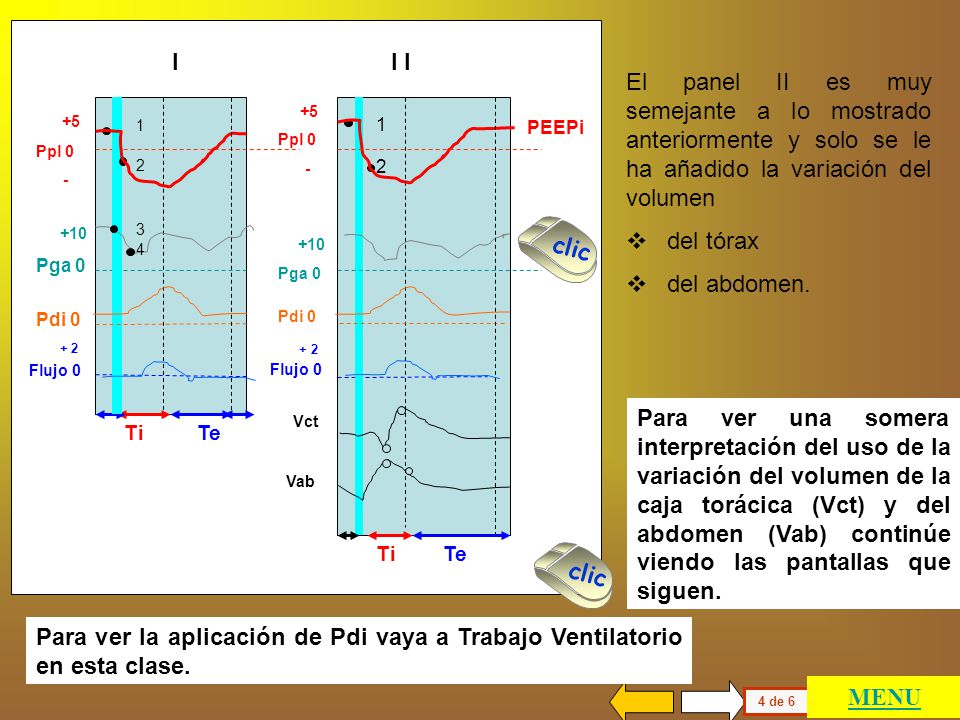 I I I. El panel II es muy semejante a lo mostrado anteriormente y solo se le ha añadido la variación del volumen.